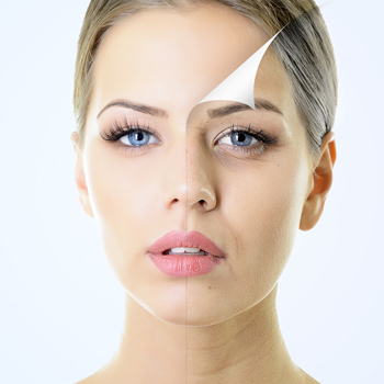 laser skin resurfacing